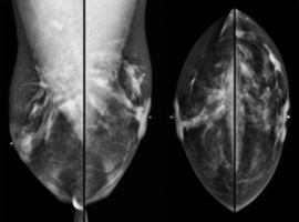 Clinical Images and Case Reports Journal (CICRJ)