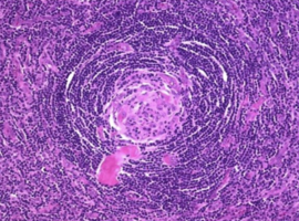 Clinical Images and Case Reports Journal (CICRJ)