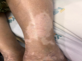 Clinical Images and Case Reports Journal (CICRJ)