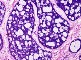 Clinical Images and Case Reports Journal (CICRJ)