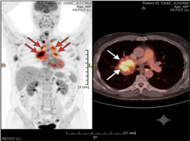 Clinical Images and Case Reports Journal (CICRJ)