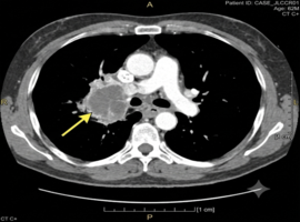 Clinical Images and Case Reports Journal (CICRJ)