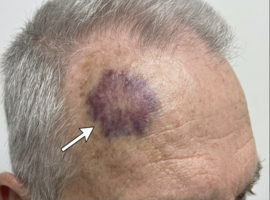 Clinical Images and Case Reports Journal (CICRJ)