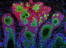Where to Publish Skin Cancer Case Reports Where to Publish Skin Cancer Case Reports